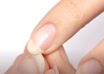 Comment reparer ongle casse