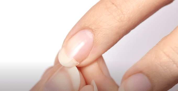 Comment reparer ongle casse